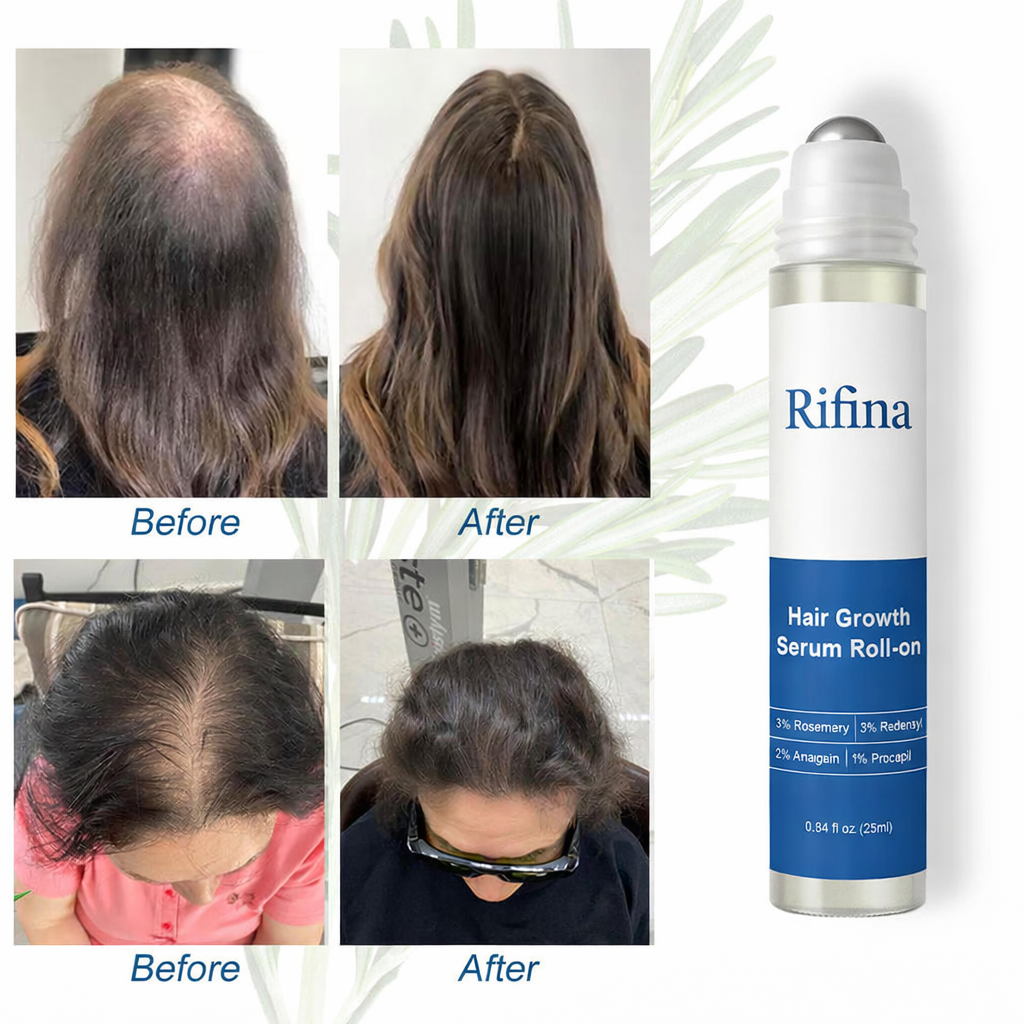 Rifina - Natural Hair Growth Serum™