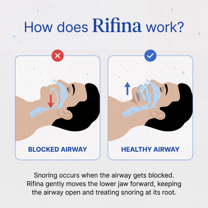 Rifina SilentNite Pro™ Anti-Snoring Mouthpiece